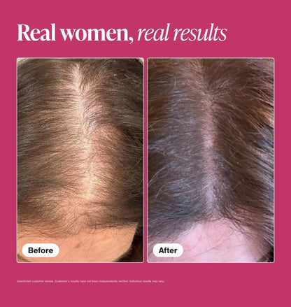 Hair Growth Supplements